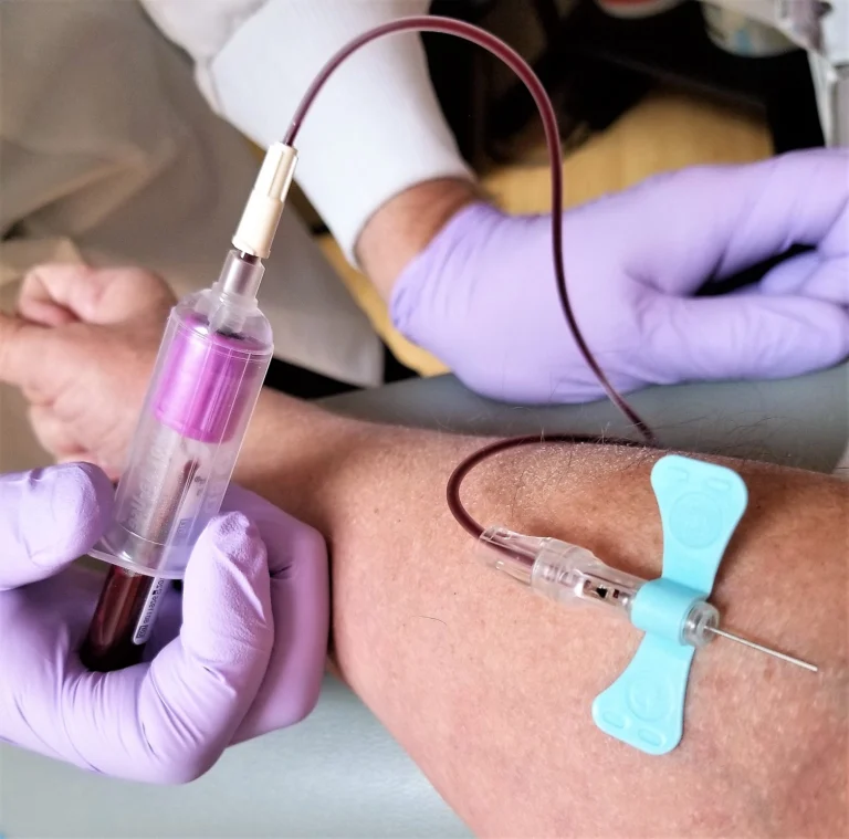 Process of Cannulation – Phlebotomy Training