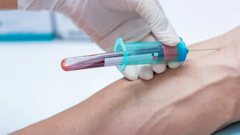 Phlebotomy Vein Selection: A Guide to Choosing the Right Vein for Blood Collection